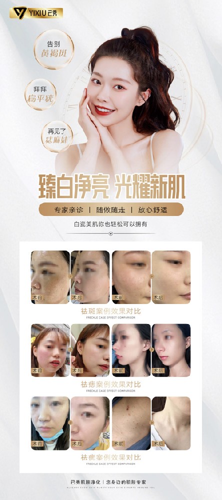 留纤生态减肥怎么样